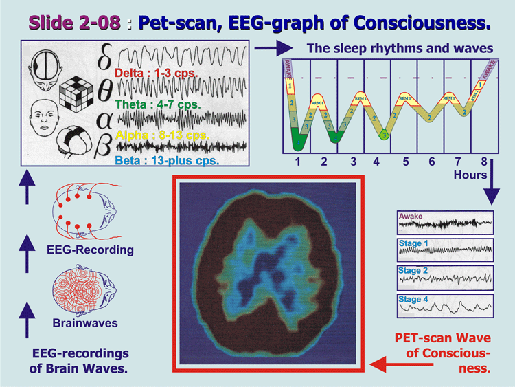 2-08_EEC-PET-Conscious.gif