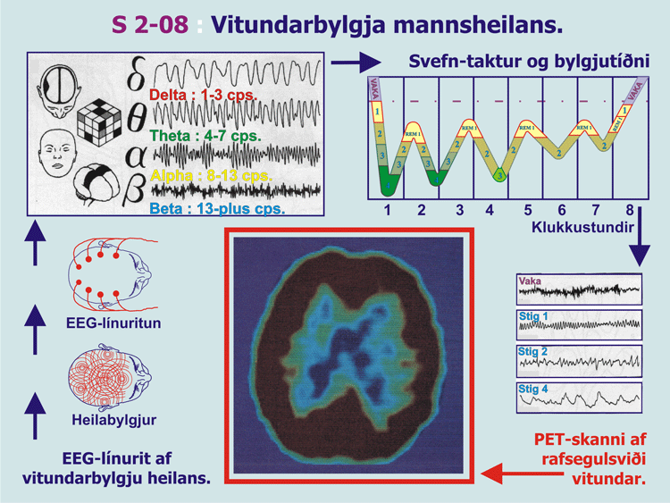 2-08_PET-EEG-Vitund.gif