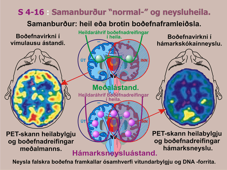 4-16_Skonnun-filtertrufluna.gif