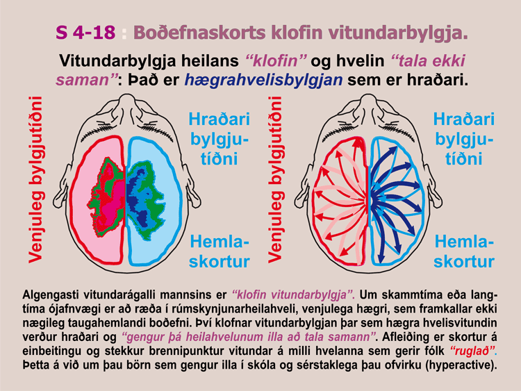 4-18_Klofin-vitundarbylgja.gif