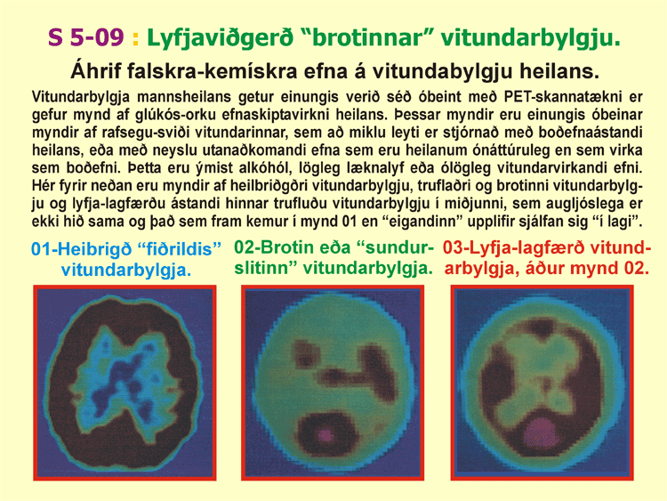 5-09_Lyfjaviderd-vitund.gif